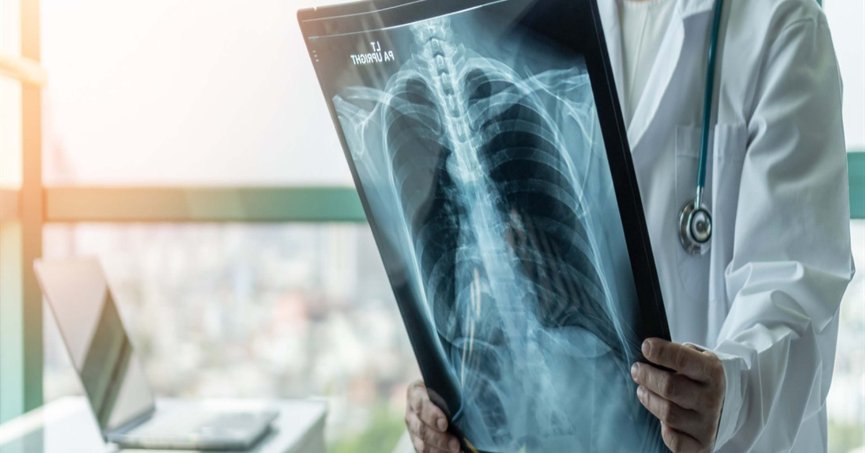 Solunum yolu enfeksiyonları nedeniyle yoğun bakıma yatışlarda artış var